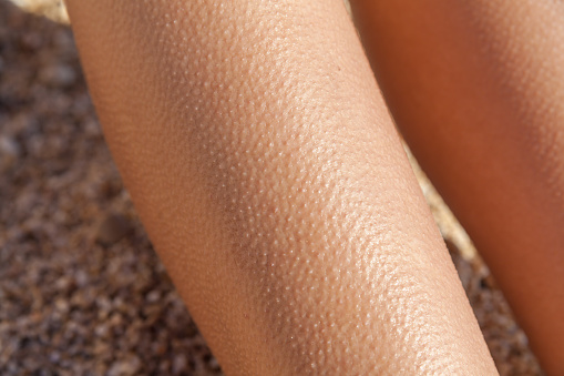 Signs and symptoms of Trypophobia